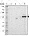 Zinc Finger Protein 670 antibody, PA5-51836, Invitrogen Antibodies, Western Blot image 