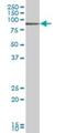 T Cell Lymphoma Invasion And Metastasis 2 antibody, H00026230-B01P, Novus Biologicals, Western Blot image 