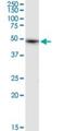 Allantoicase antibody, H00055821-D01P, Novus Biologicals, Western Blot image 