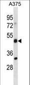 Adhesion Regulating Molecule 1 antibody, LS-C157539, Lifespan Biosciences, Western Blot image 