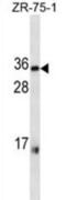 Major Histocompatibility Complex, Class II, DR Alpha antibody, abx025308, Abbexa, Western Blot image 