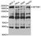 SET Domain Bifurcated Histone Lysine Methyltransferase 1 antibody, orb247285, Biorbyt, Western Blot image 