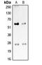 Protein C Receptor antibody, LS-C368475, Lifespan Biosciences, Western Blot image 