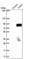 Tyrosinase Related Protein 1 antibody, NBP1-88370, Novus Biologicals, Western Blot image 