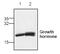 Growth Hormone 2 antibody, TA319127, Origene, Western Blot image 