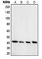 Protein Kinase CAMP-Dependent Type I Regulatory Subunit Alpha antibody, LS-B13583, Lifespan Biosciences, Western Blot image 