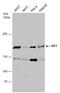 Kinesin-like protein KIF7 antibody, GTX130782, GeneTex, Western Blot image 