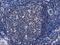 CTD Small Phosphatase 1 antibody, LS-C172527, Lifespan Biosciences, Immunohistochemistry paraffin image 
