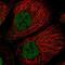 Transcription Factor 20 antibody, NBP2-31968, Novus Biologicals, Immunofluorescence image 
