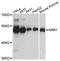 KRR1 Small Subunit Processome Component Homolog antibody, A4487, ABclonal Technology, Western Blot image 