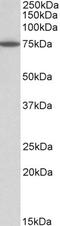 Terminal Nucleotidyltransferase 4B antibody, EB10875, Everest Biotech, Western Blot image 