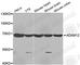 ADAM Metallopeptidase Domain 12 antibody, A4200, ABclonal Technology, Western Blot image 