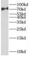 Sentrin-specific protease 1 antibody, FNab07712, FineTest, Western Blot image 