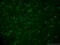 Calbindin 1 antibody, 66394-1-Ig, Proteintech Group, Immunofluorescence image 