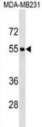 Forkhead Box Q1 antibody, abx030577, Abbexa, Western Blot image 