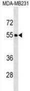 Forkhead box protein Q1 antibody, abx030577, Abbexa, Western Blot image 