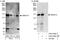 Ankyrin Repeat And Sterile Alpha Motif Domain Containing 1A antibody, A303-050A, Bethyl Labs, Immunoprecipitation image 