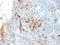 Major Histocompatibility Complex, Class II, DR Alpha antibody, M01195-1, Boster Biological Technology, Immunohistochemistry paraffin image 