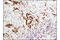 PCNA antibody, 13110S, Cell Signaling Technology, Immunohistochemistry paraffin image 