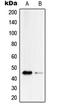 Serpin B4 antibody, LS-C352818, Lifespan Biosciences, Western Blot image 