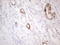 Alpha-Methylacyl-CoA Racemase antibody, LS-C794391, Lifespan Biosciences, Immunohistochemistry paraffin image 