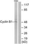 Cyclin B1 antibody, TA312651, Origene, Western Blot image 