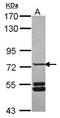 Sorting nexin-33 antibody, GTX119295, GeneTex, Western Blot image 