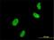 Ubiquitin Like With PHD And Ring Finger Domains 1 antibody, H00029128-M01, Novus Biologicals, Immunocytochemistry image 