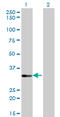 Serine/Threonine Kinase 16 antibody, LS-B4472, Lifespan Biosciences, Western Blot image 