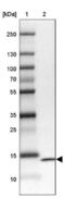 Parvalbumin antibody, NBP2-33529, Novus Biologicals, Western Blot image 