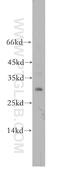 Homeobox D12 antibody, 18735-1-AP, Proteintech Group, Western Blot image 