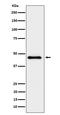 Elongator Acetyltransferase Complex Subunit 4 antibody, M07167-1, Boster Biological Technology, Western Blot image 