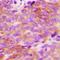 ADA1D antibody, orb382461, Biorbyt, Immunohistochemistry paraffin image 