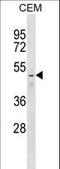 Farnesyltransferase, CAAX Box, Beta antibody, LS-C166201, Lifespan Biosciences, Western Blot image 