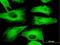 Tubulin Beta 2A Class IIa antibody, H00007280-M04, Novus Biologicals, Immunocytochemistry image 