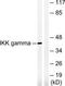 Inhibitor Of Nuclear Factor Kappa B Kinase Regulatory Subunit Gamma antibody, TA311840, Origene, Western Blot image 