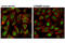 Forkhead Box O3 antibody, 99199S, Cell Signaling Technology, Immunofluorescence image 
