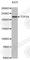 DNA Topoisomerase II Alpha antibody, A0725, ABclonal Technology, Western Blot image 