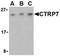 C1q And TNF Related 7 antibody, ADI-905-720-100, Enzo Life Sciences, Western Blot image 