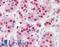 Apurinic/Apyrimidinic Endodeoxyribonuclease 1 antibody, LS-B3179, Lifespan Biosciences, Immunohistochemistry frozen image 
