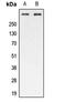 ATM Serine/Threonine Kinase antibody, MBS820251, MyBioSource, Western Blot image 