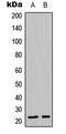 Claudin 19 antibody, LS-C354217, Lifespan Biosciences, Western Blot image 