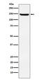 Jagged Canonical Notch Ligand 2 antibody, M01428, Boster Biological Technology, Western Blot image 
