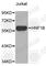 HNF1 Homeobox B antibody, A4145, ABclonal Technology, Western Blot image 