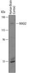 Membrane Associated Guanylate Kinase, WW And PDZ Domain Containing 2 antibody, PA5-47901, Invitrogen Antibodies, Western Blot image 