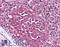 Interleukin 1 Receptor Associated Kinase 3 antibody, LS-B1370, Lifespan Biosciences, Immunohistochemistry frozen image 