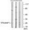 Tumor Protein P53 Inducible Nuclear Protein 1 antibody, abx013751, Abbexa, Western Blot image 