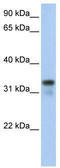 Glycine-N-Acyltransferase Like 2 antibody, TA329583, Origene, Western Blot image 