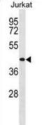 Thyrotropin Releasing Hormone Receptor antibody, abx030262, Abbexa, Western Blot image 