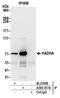 Hydroxyacyl-CoA Dehydrogenase Trifunctional Multienzyme Complex Subunit Alpha antibody, A305-317A, Bethyl Labs, Immunoprecipitation image 